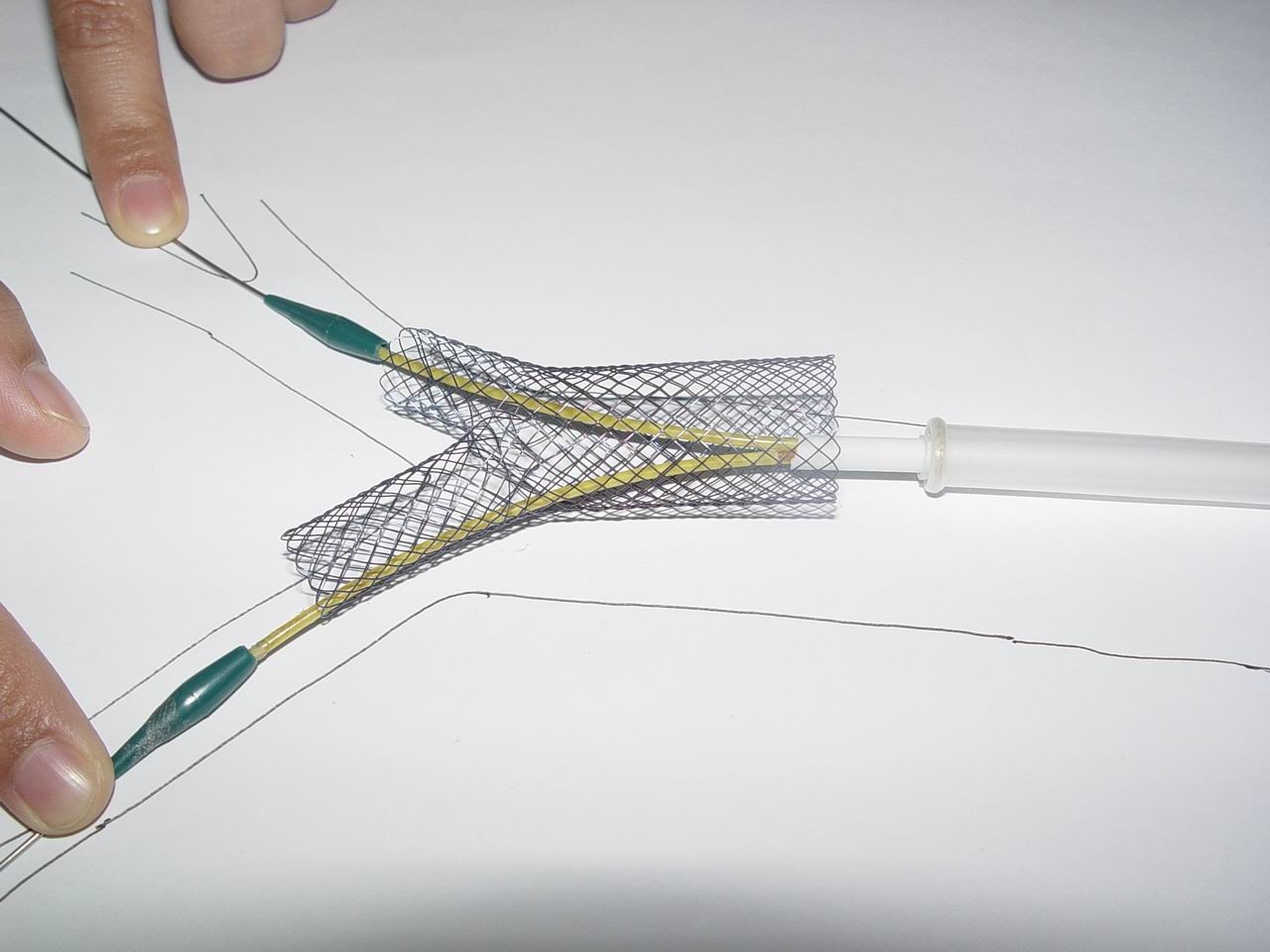 MICRO-TECH carina Y-stent