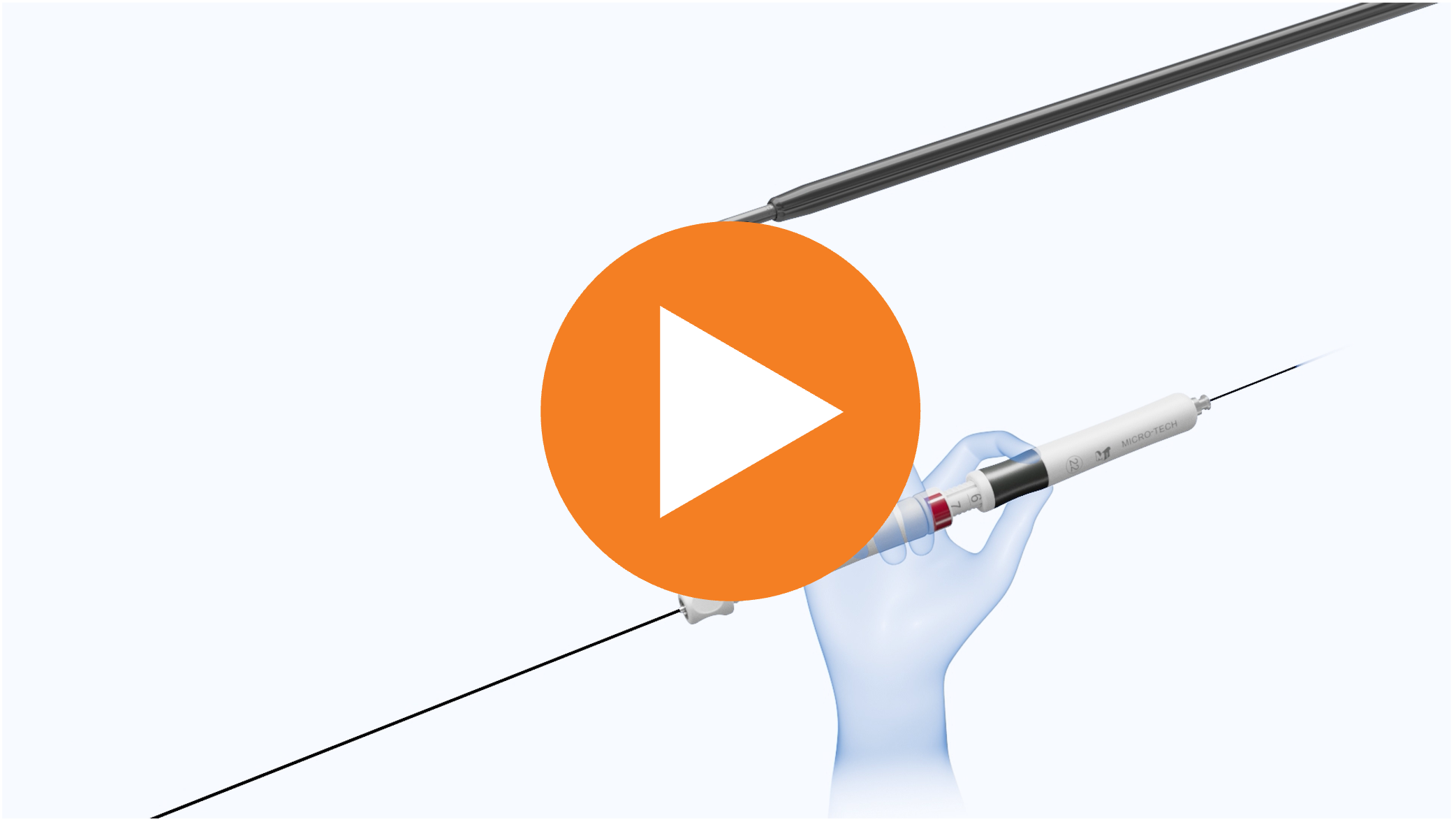Trident™ Endoscopic Ultrasound Fine Needle Biopsy (FNB) Device Product Video
